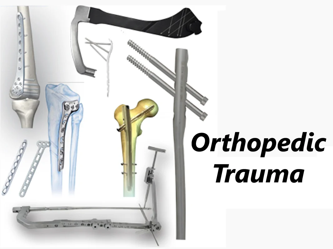 Orthopedic Trauma