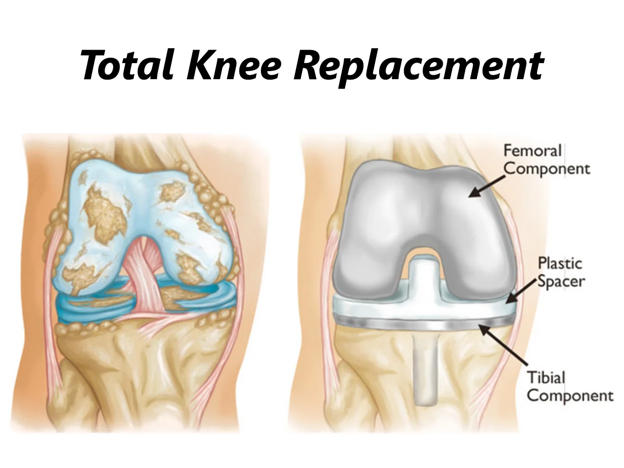 Orthopedic